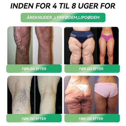 𝐎𝐟𝐟𝐢𝐜𝐢𝐞𝐥 𝐛𝐮𝐭𝐢𝐤 | 𝐇𝗛𝗩𝗕® 👩‍⚕️𝐆𝐿𝑃-𝟏 𝐒𝐈𝐗-𝐈𝐍-𝐎𝐍𝐄 𝐒𝐮𝐧𝐝𝐡𝐞𝐝𝐬𝐥ø𝐬𝐧𝐢𝐧𝐠 𝐎𝐫𝐚𝐥 𝐕æ𝐬𝐤𝐞 (𝐊𝐮𝐧 é𝐧 𝐠𝐚𝐧𝐠 𝐨𝐦 𝐝𝐚𝐠𝐞𝐧, 𝐬𝐲𝐧𝐥𝐢𝐠𝐞 𝐫𝐞𝐬𝐮𝐥𝐭𝐚𝐭𝐞𝐫 𝐩å 𝟕 𝐝𝐚𝐠𝐞) 👩‍⚕️ 𝐓𝐢𝐥 𝐟𝐞𝐝𝐦𝐞, 𝐡𝐣𝐞𝐫𝐭𝐞-𝐤𝐚𝐫-𝐬𝐮𝐧𝐝𝐡𝐞𝐝, 𝐝𝐢𝐚𝐛𝐞𝐭𝐞𝐬, 𝐬ø𝐯𝐧𝐚𝐩𝐧ø, 𝐭𝐚𝐫𝐦𝐡𝐞𝐥𝐛𝐫𝐞𝐝, 𝐥𝐞𝐝𝐬𝐦𝐞𝐫𝐭𝐞𝐫 𝐨𝐠 𝐦𝐞𝐠𝐞𝐭 𝐦𝐞𝐫𝐞